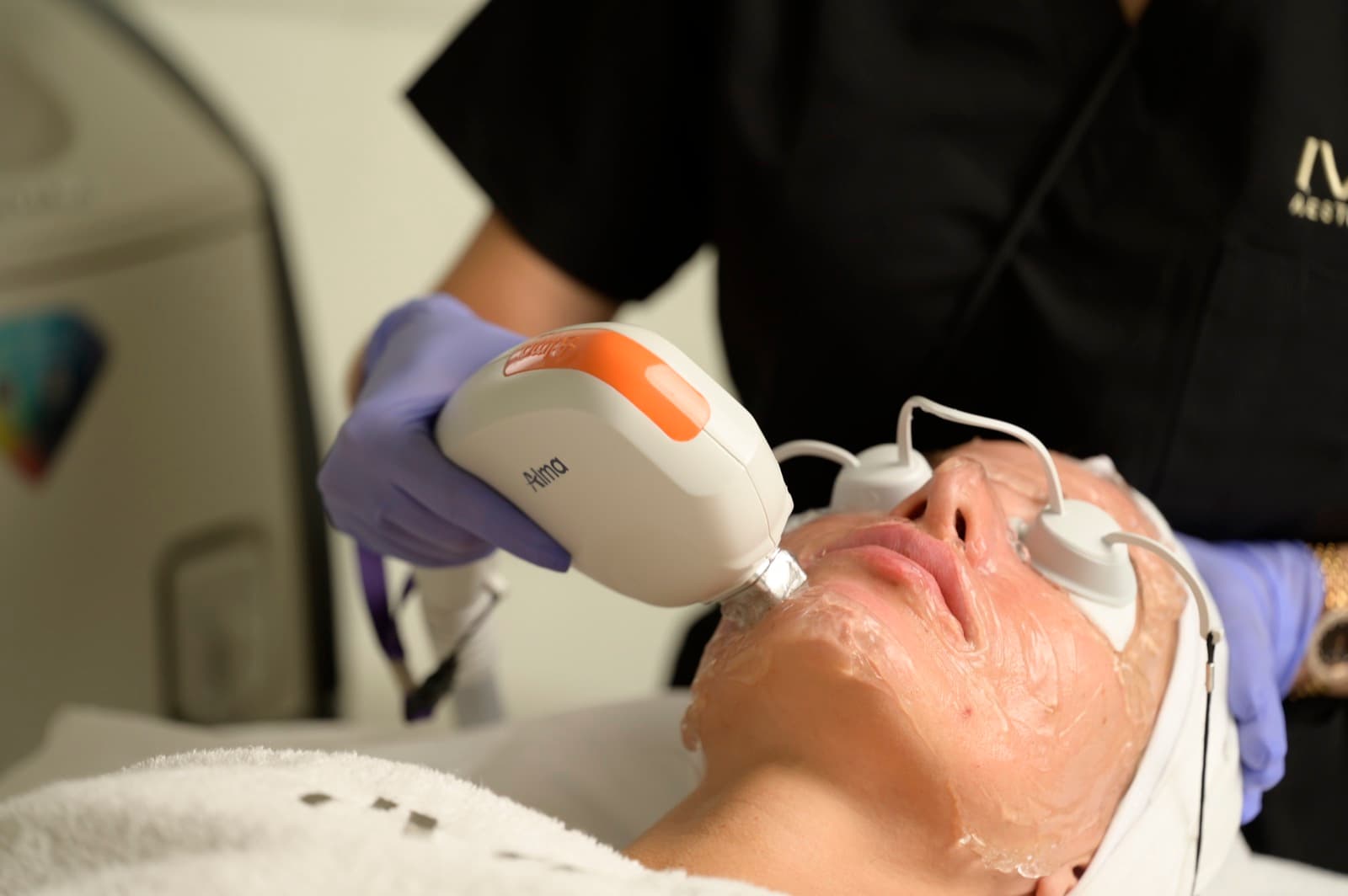 AFT Dye-SR Photofacial treatment at Ivory Aesthetics Clinic