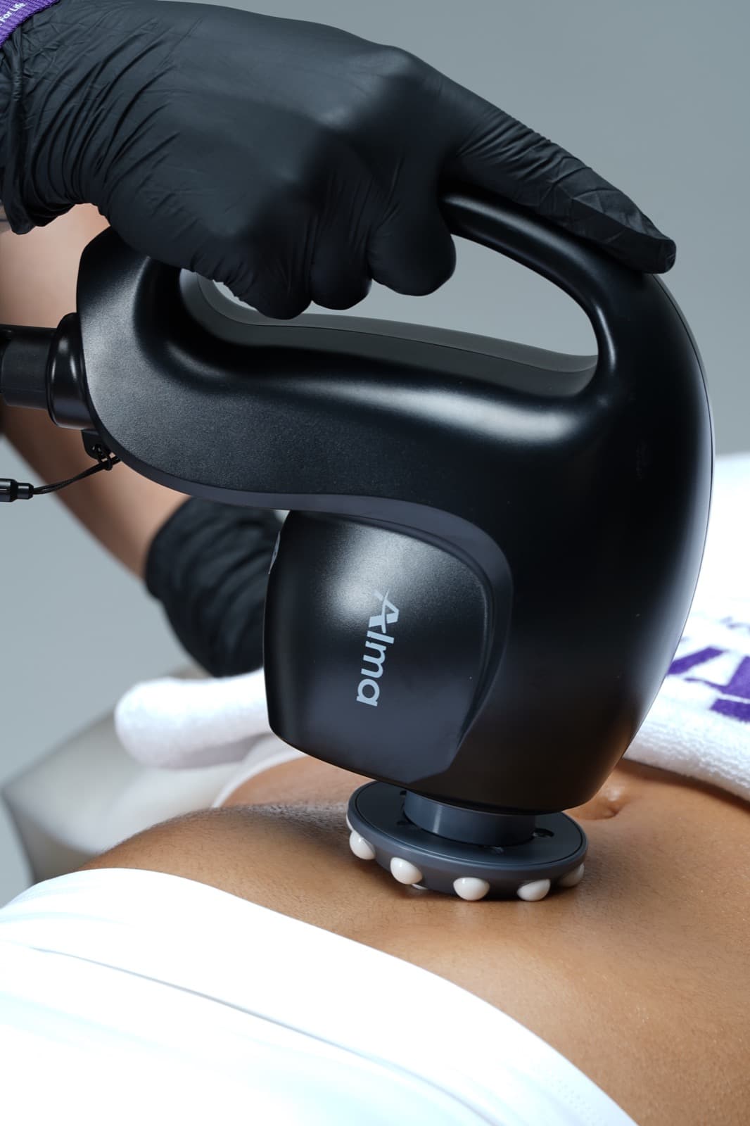 PrimeX body contouring treatment at Ivory Aesthetics Clinic