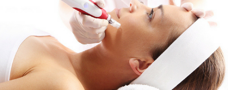 Why You Should Avoid Laser Treatments For Facial Scars