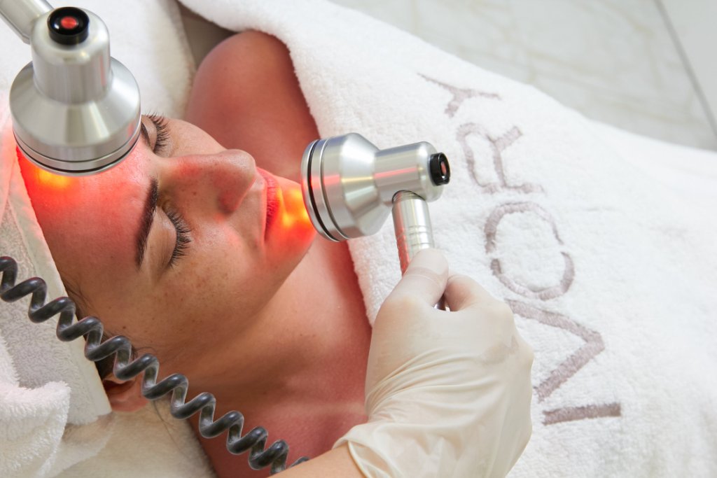 Laser free acne scar treatments you should try