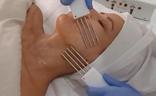 what is Microcurrent Facial