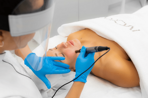 3 types of Microneedling that are trending right now