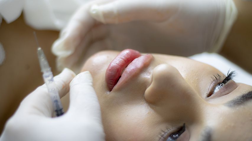 5 Questions To Ask Before Getting Lip Fillers