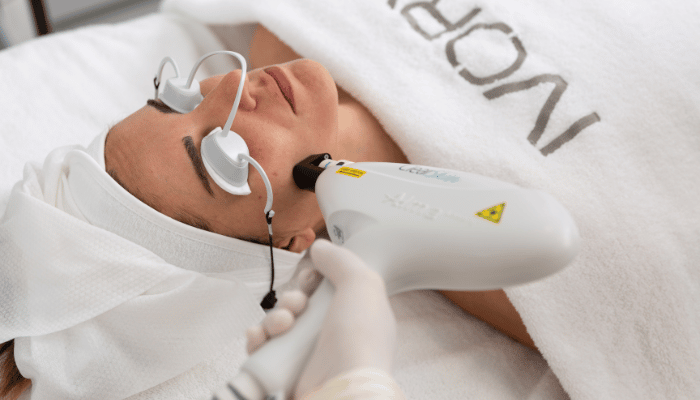 Try this laser technology to treat acne