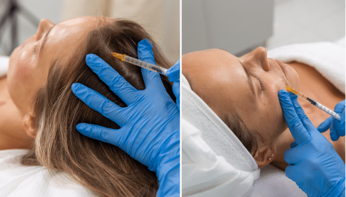 PRP Therapy – The Secret to Hair Growth and Rejuvenation