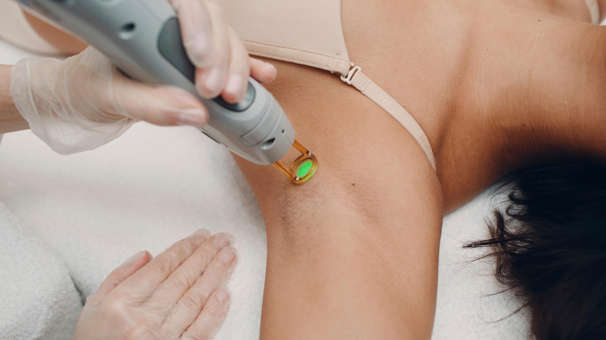 How Effective are Laser Hair Removal Treatments?