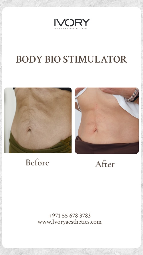 Key Benefits of Body Bio Stimulator