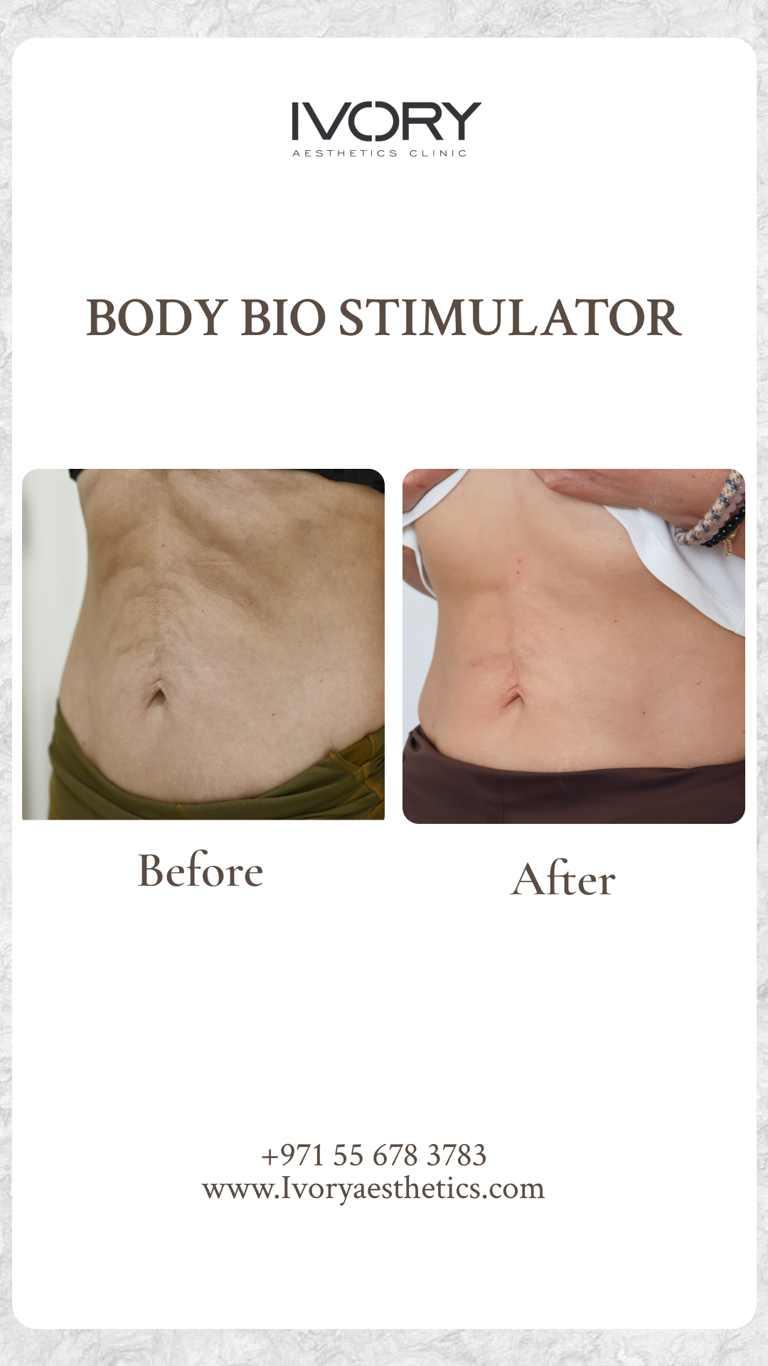 Body Bio Stimulator